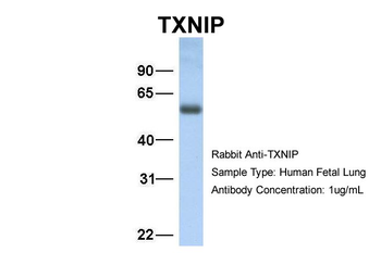 TXNIP Rabbit Polyclonal Antibody