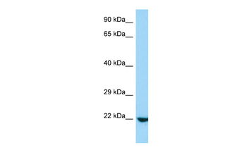 Rasl10a Rabbit Polyclonal Antibody