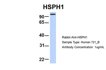 HSPH1 Rabbit Polyclonal Antibody