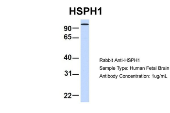 HSPH1 Rabbit Polyclonal Antibody