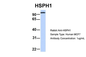 HSPH1 Rabbit Polyclonal Antibody