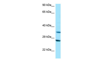 TOMM34 Rabbit Polyclonal Antibody