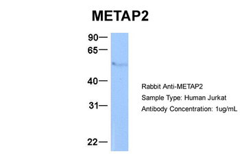 METAP2 Rabbit Polyclonal Antibody