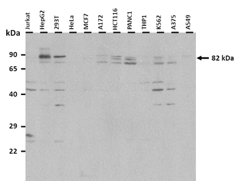 DNM1L Rabbit Polyclonal Antibody