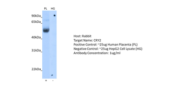 CRY2 Rabbit Polyclonal Antibody