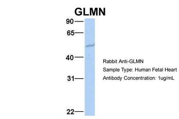 GLMN Rabbit Polyclonal Antibody