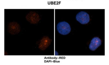 UBE2F Rabbit Polyclonal Antibody