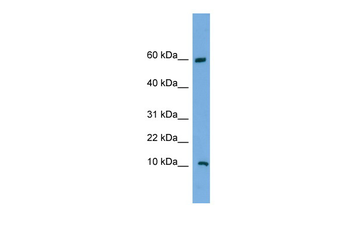 C20orf144 Rabbit Polyclonal Antibody