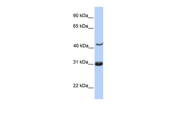 NUP35 Rabbit Polyclonal Antibody