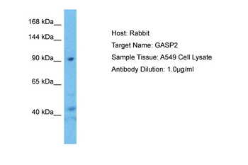 GPRASP2 Rabbit Polyclonal Antibody