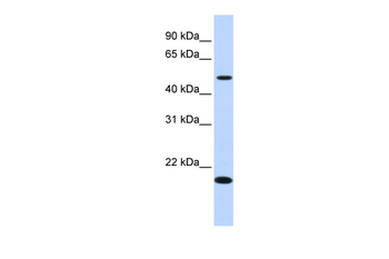 EXOC3-AS1 Rabbit Polyclonal Antibody