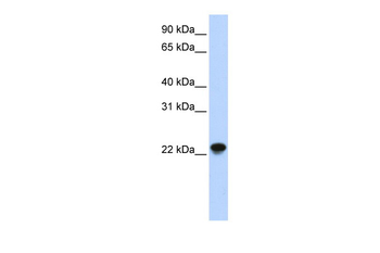 ARL8A Rabbit Polyclonal Antibody