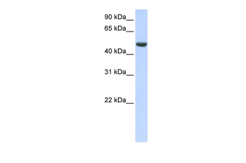 SPATA17 Rabbit Polyclonal Antibody