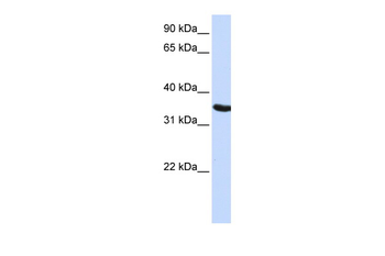 DPPA2 Rabbit Polyclonal Antibody