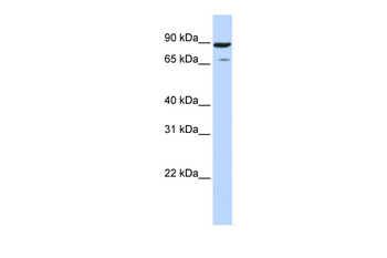 HIPK4 Rabbit Polyclonal Antibody