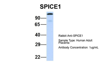CCDC52 Rabbit Polyclonal Antibody