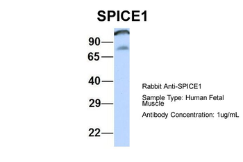 CCDC52 Rabbit Polyclonal Antibody