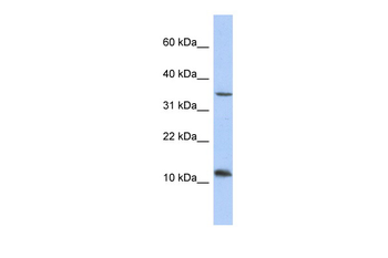 NXNL2 Rabbit Polyclonal Antibody