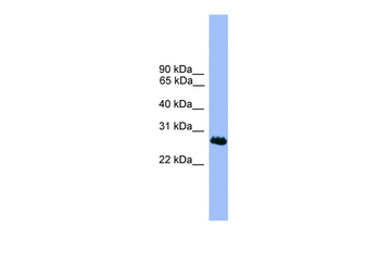 C1orf216 Rabbit Polyclonal Antibody