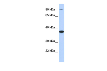 BBS5 Rabbit Polyclonal Antibody