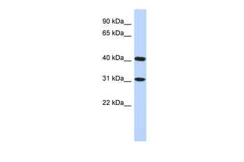 TENT5D Rabbit Polyclonal Antibody