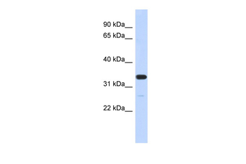 FAM76A Rabbit Polyclonal Antibody