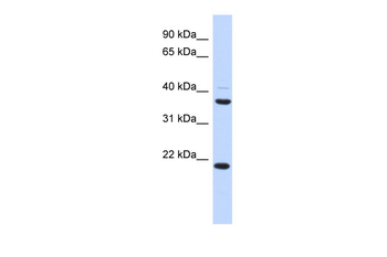 TMEM74 Rabbit Polyclonal Antibody