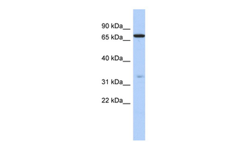 ATXN7L2 Rabbit Polyclonal Antibody