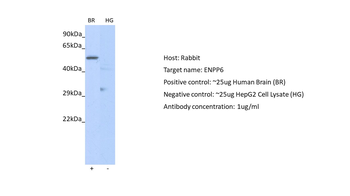 ENPP6 Rabbit Polyclonal Antibody