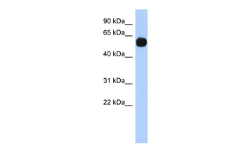 MPP7 Rabbit Polyclonal Antibody