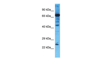 CHMP4B Rabbit Polyclonal Antibody