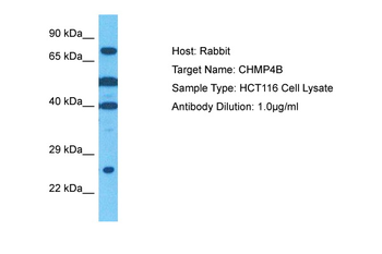 CHMP4B Rabbit Polyclonal Antibody