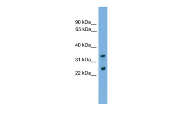 CHMP4B Rabbit Polyclonal Antibody