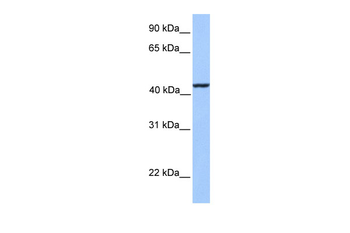 KLC3 Rabbit Polyclonal Antibody