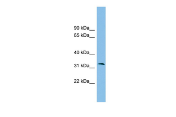 ZPBP2 Rabbit Polyclonal Antibody