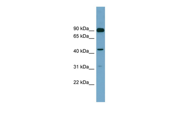 DGKA Rabbit Polyclonal Antibody