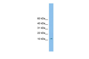 CHCHD1 Rabbit Polyclonal Antibody