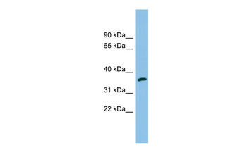 AKR1C2 Rabbit Polyclonal Antibody