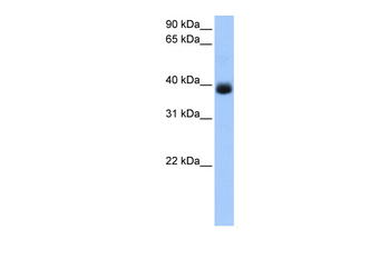 SERPINA5 Rabbit Polyclonal Antibody