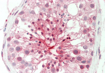 SERPINA5 Rabbit Polyclonal Antibody