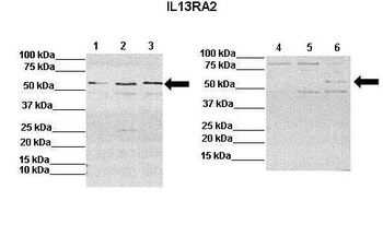 IL13RA2 Rabbit Polyclonal Antibody
