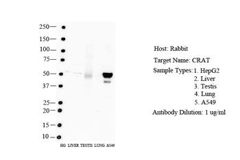 CRAT Rabbit Polyclonal Antibody