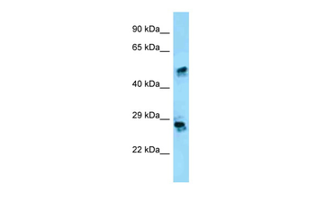 CRISP1 Rabbit Polyclonal Antibody