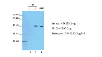 CSNK2A2 Rabbit Polyclonal Antibody