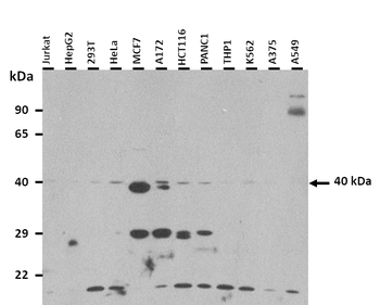 INHA Rabbit Polyclonal Antibody