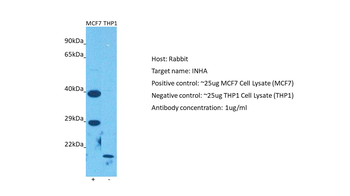 INHA Rabbit Polyclonal Antibody