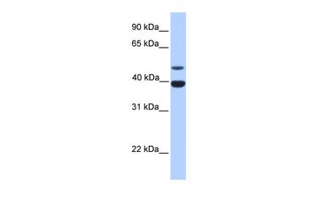INHA Rabbit Polyclonal Antibody