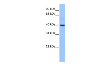 PDXK Rabbit Polyclonal Antibody