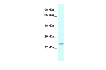 Cdkn3 Rabbit Polyclonal Antibody
