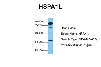 HSPA1L Rabbit Polyclonal Antibody